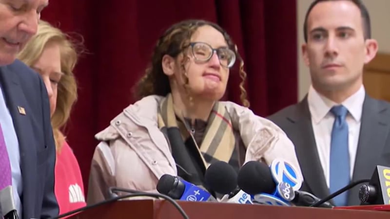 Tras larga espera, sentarán en el banquillo de los acusados a sospechoso de arrojarle ácido en...